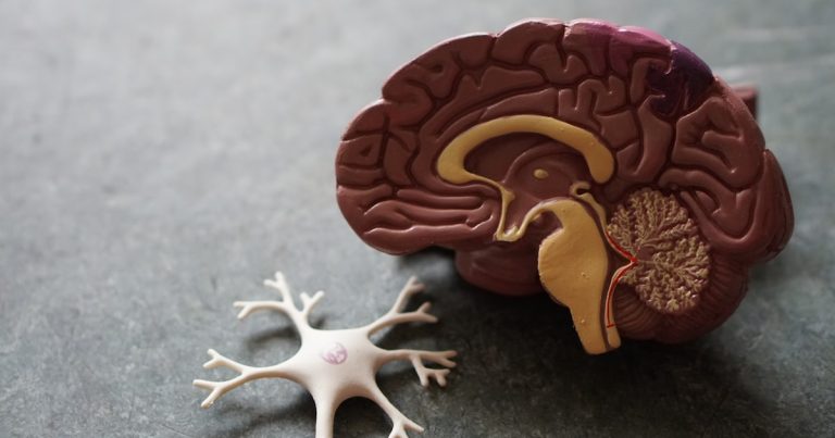 Leaky gut syndrome and gut health