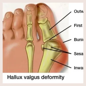 Metro Podiatrists