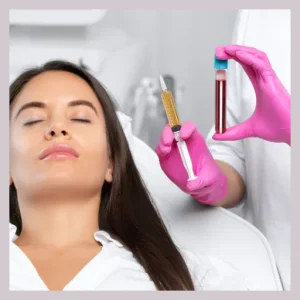 V.A. MD PRP Treatments